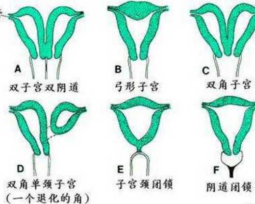 (a)代孕包成功中心,广州妇幼保健院做供卵试管包男孩多少钱？十二万够吗？